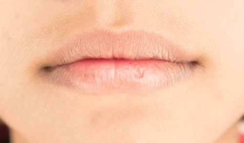 Để có làn môi mềm mịn, bạn nên tiến hành tẩy da chết cho môi